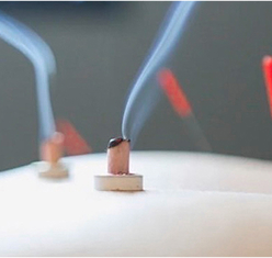 背中に置かれたお灸からやさしく煙が立ちのぼる様子