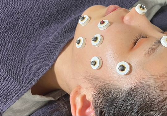 横になった女性の顔にお灸をしている施術の様子